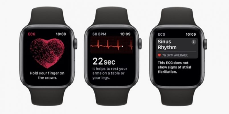 tcl move smart band